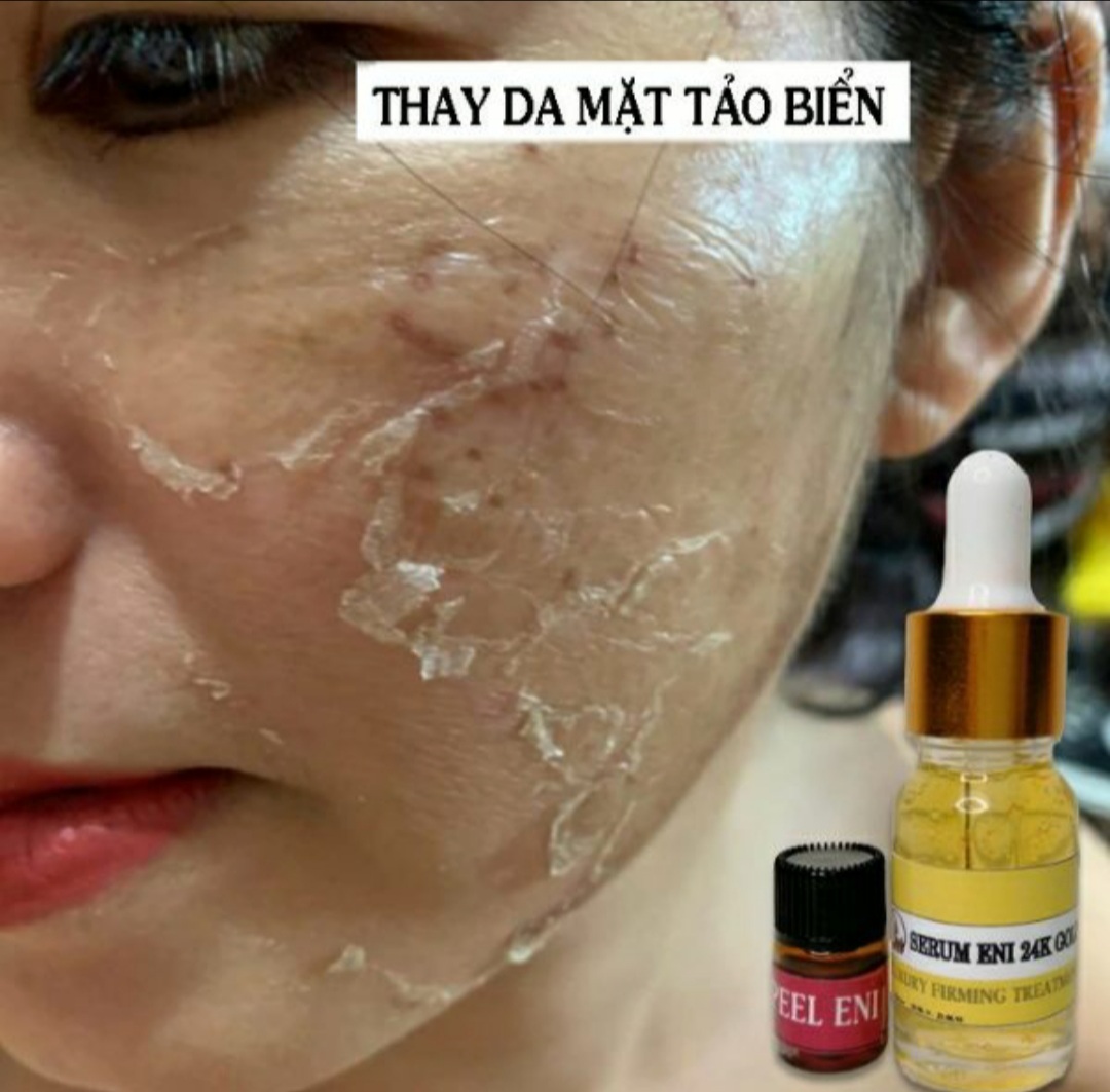 [HCM]TINH CHẤT THAY DA TẢO BIỂN TẶNG SERUM 24k