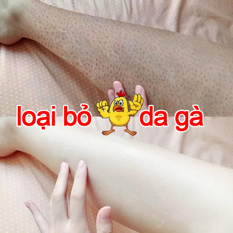 Tẩy tế bào chết toàn thân Kem tẩy tế bào chết 5 ngày Tẩy tế bào chết mịn màng Cải thiện tình trạng nổi da gà làm sáng da