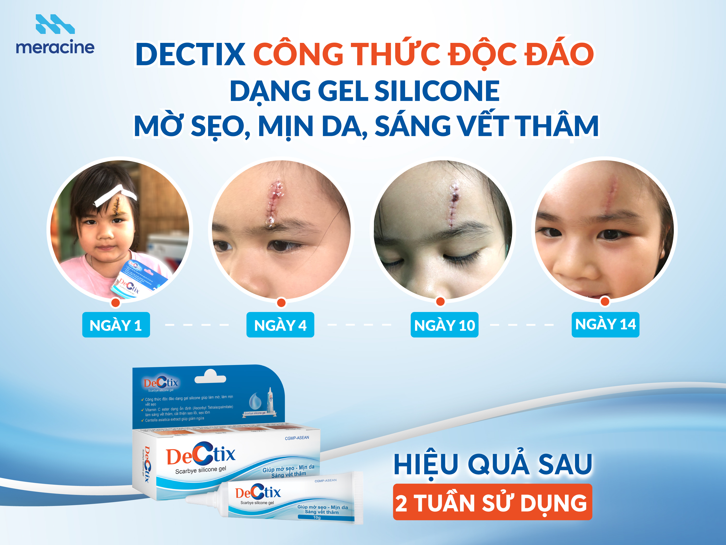 Gel bôi sẹo Dectix giúp làm mờ, mịn, sáng vết sẹo, thâm Scarbye Silicone Hộp 10g