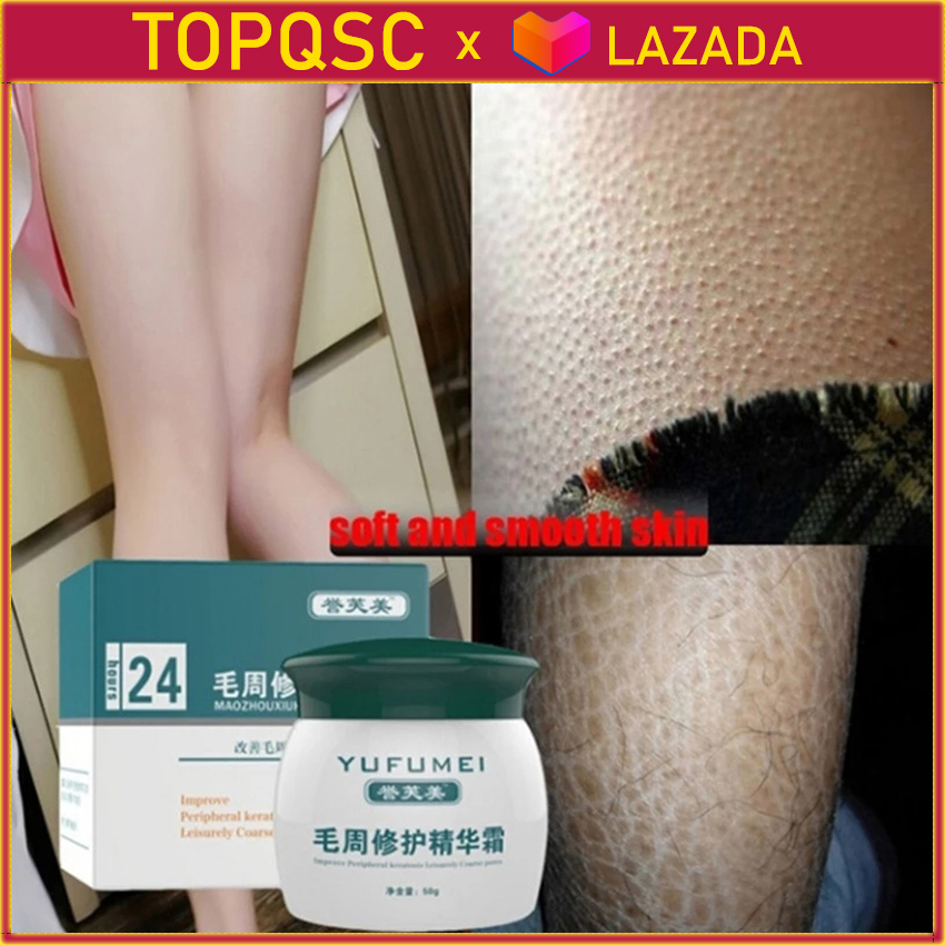 【Còn Hàng x TOPQSC】50G Dầu Hỏa Đóng Rắn Pilaris/ Kp/ Sữa Dưỡng Thể Da Gà Kem Phục Hồi Da, Tinh Chất Chăm Sóc Da Dưỡng Ẩm Và Nuôi Dưỡng