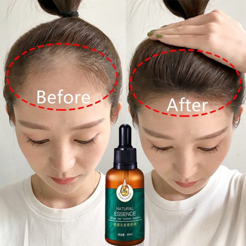 Kích thích mọc tóc Thuốc kích thích mọc tóc Tinh dầu dưỡng tóc 30ml chăm sóc giúp mọc tóc Ngăn Ngừa Tóc Gãy Rụng Tinh dầu mọc tóc Mọc lại tóc 30ml nuôi dưỡng tóc tinh chất dưỡng tóc làm chắc khỏe chân tóc, ngăn ngừa rụng tóc, phục hồi tóc hư tổn