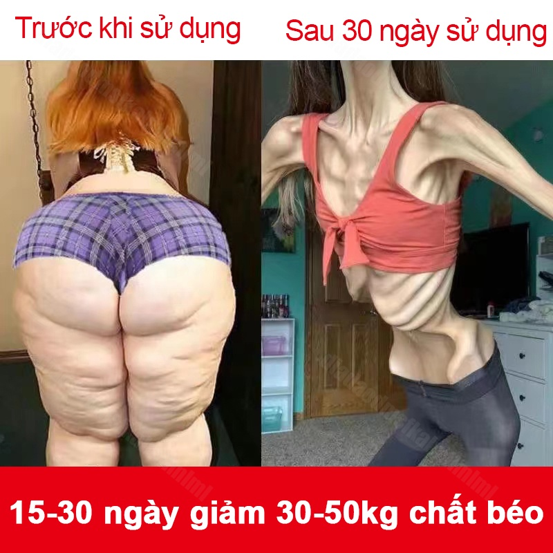 Giảm cân hiệu quả nhanh chóng sau 7 ngày, làm đẹp giảm cân thon thân miếng dán giảm cân đốt mỡ bụng,chỉ cần nằm là có thể giảm cân một cách dễ dàng.