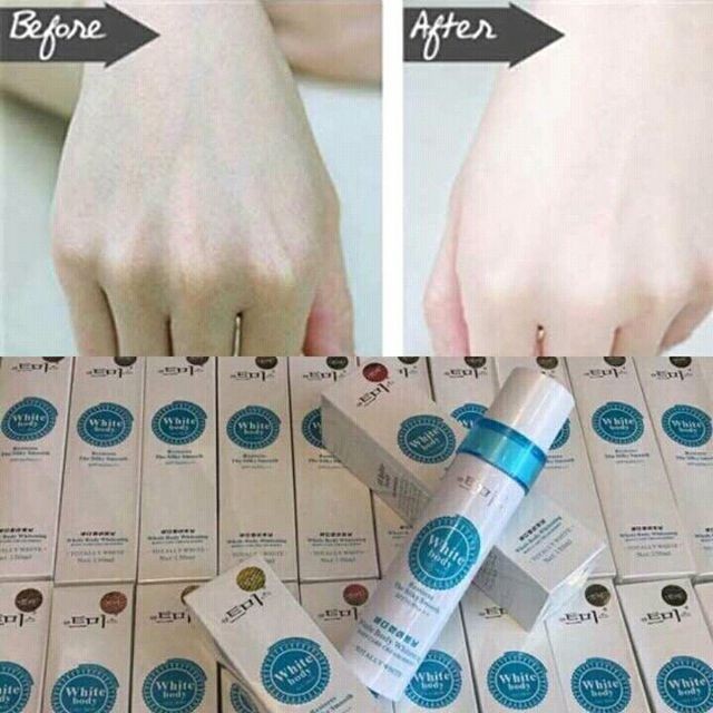 Kem kích trắng body Beauty Xóa mờ thâm nám 150ml