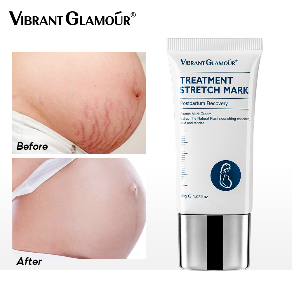 VIBRANT GLAMOUR Kem Vết rạn da chống nhăn da làm săn chắc cơ thể rạn da tuổi dậy thì nhăn da Làm mờ sẹo Làm mờ vết rạn da Remove Stretch Mark Cream