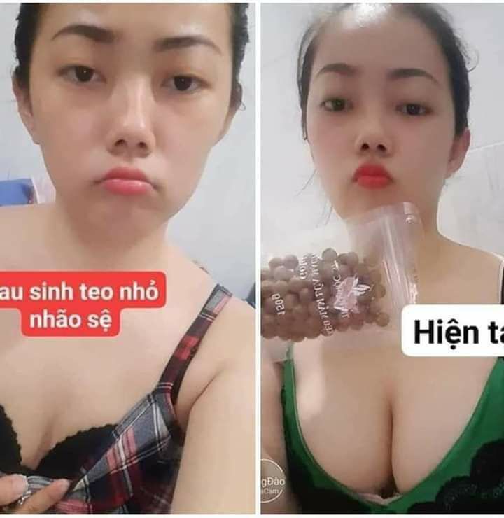 Kẹo mầm kích thích vòng 1 to săn chắc đẫy đà
