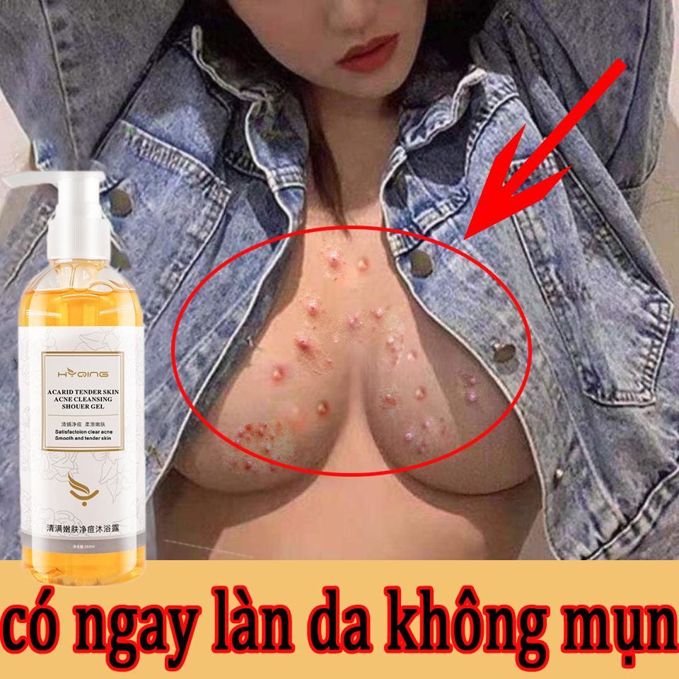 Sữa tắm làm trắng da bằng thảo mộc sữa tắm sạch mụn sữa tắm dưỡng ẩm làm trắng da, Làm sáng đều màu da, giảm thâm nám, trắng da, kháng khuẩn làm sạch sâu 260ml