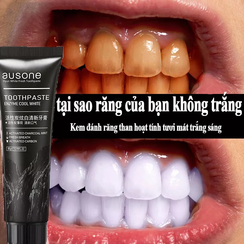 ⚡sp mới nhất⚡Kem đánh răng làm trắng và sáng răng kem đánh răng hoạt tính than tre  Giúp làm trắng răng, giảm ố vàng, khử mùi hôi, chống sưng nướu, chống chảy máu nướu răng 85g