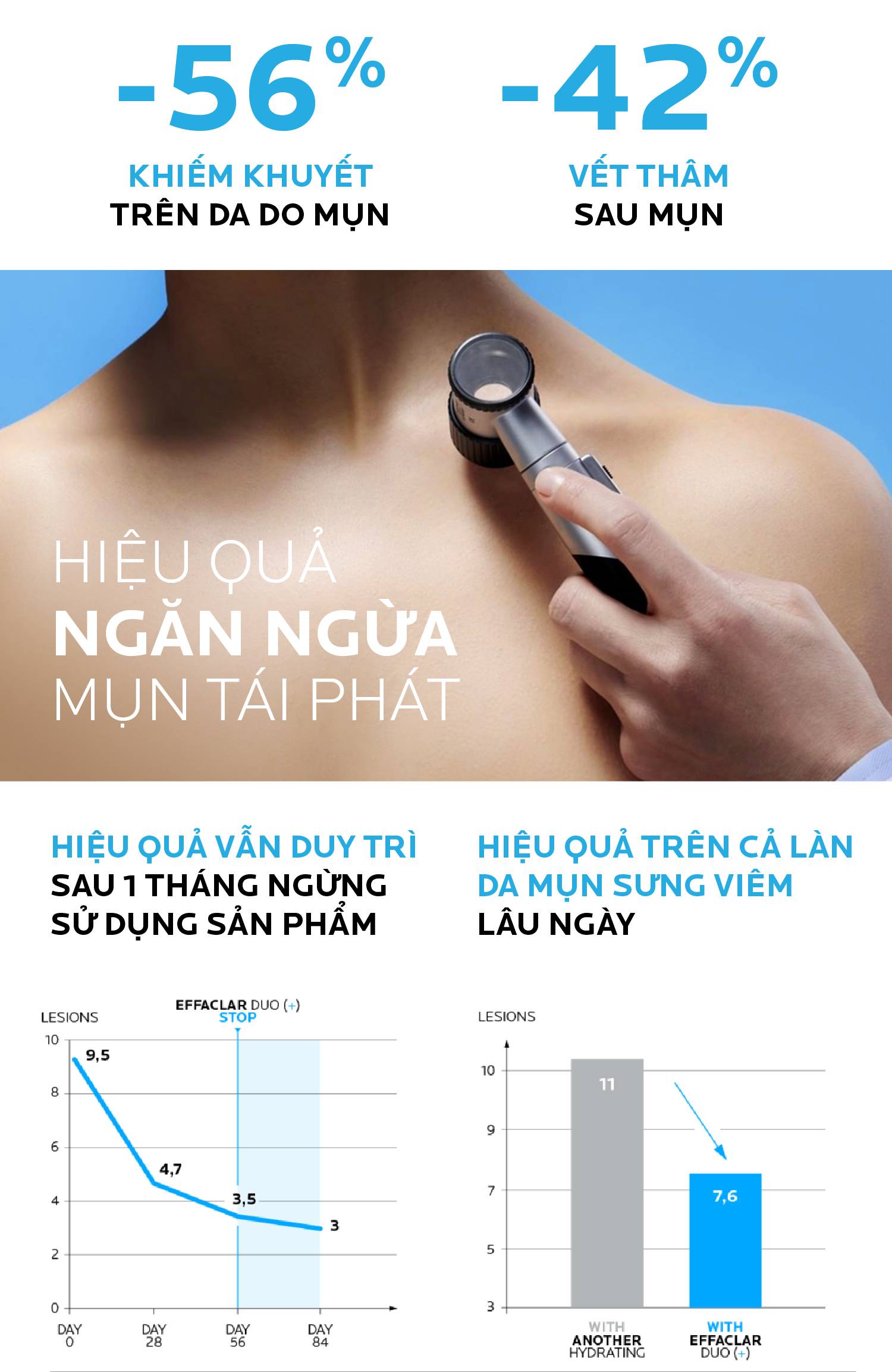 Bộ đôi Kem dưỡng giảm mụn thông thoáng lỗ chân lông và ngừa thâm La Roche Posay Effaclar Duo+ 40ml và Gel rửa mặt dành cho da dầu mụn Effaclar gel 50ml - Giới hạn 5sp/khách 4 88c6d9665e5ca973551d4d512f7733f6