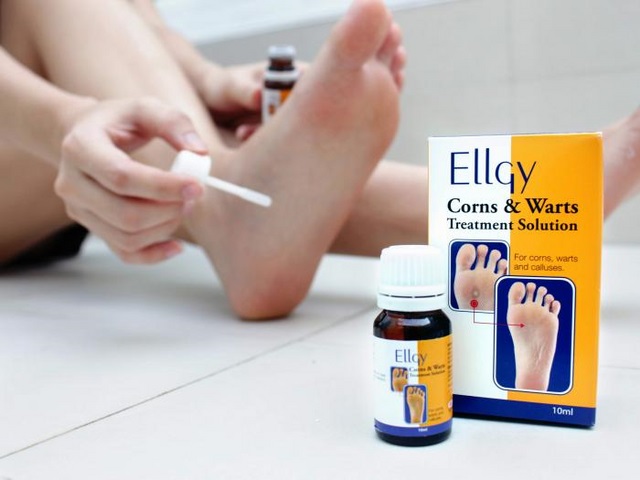 Dung dịch Ellgy Corns & Warts loại sạch mụn cóc, mụn cơm, chai mắt cá chân.