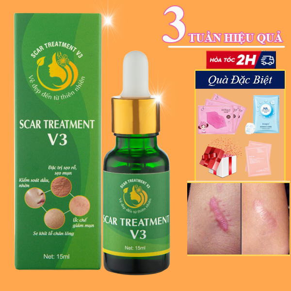 Serum sẹo rỗ lõm lâu năm streament v3 kem ngừa sẹo hiệu quả