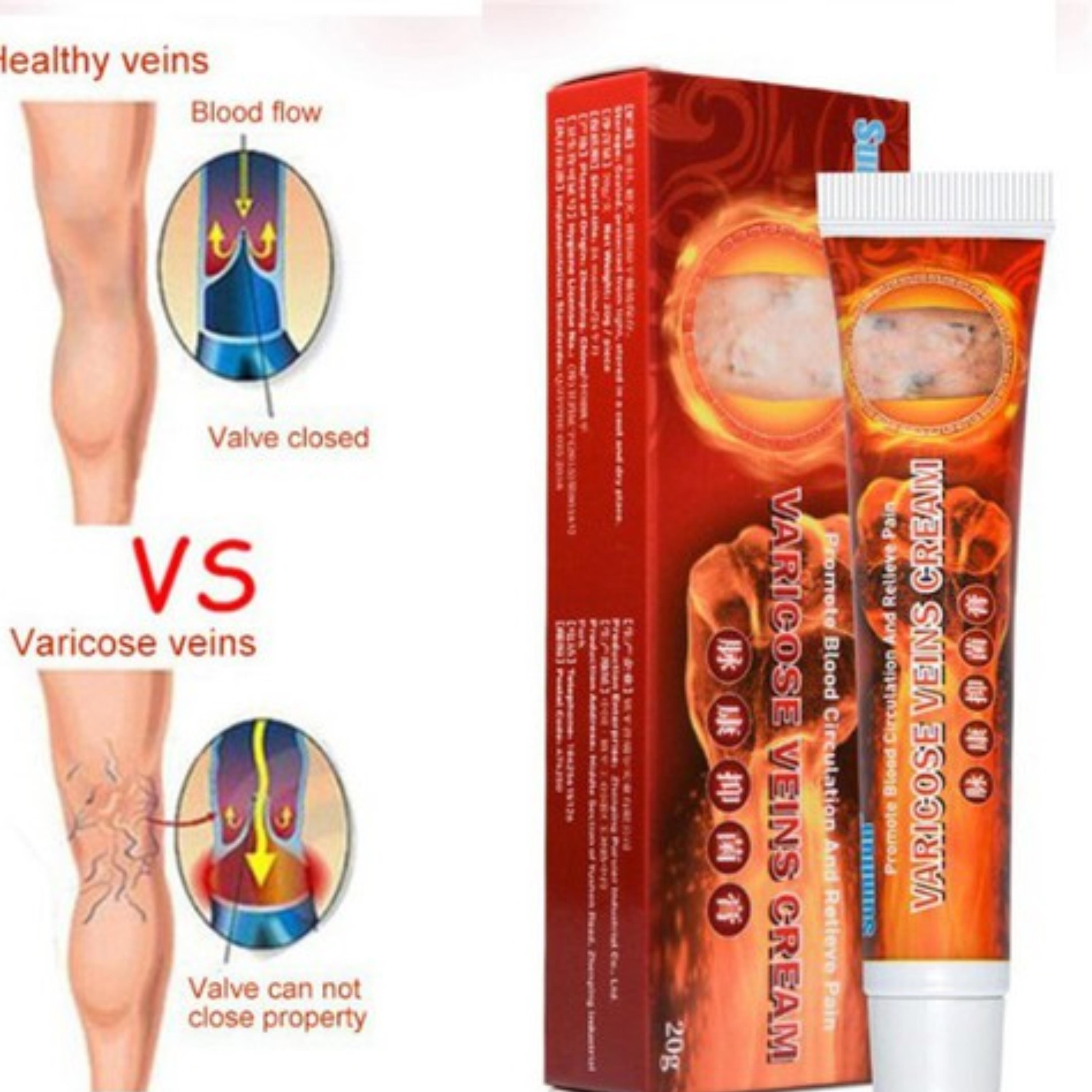 Kem bôi da suy giãn tĩnh mạch hiệu quả sumifun Nội địa Trung