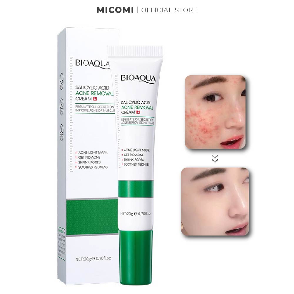 Kem Giảm Mụn Giảm Sưng Mụn Đỏ Loại Bỏ Mụn Trứng Cá Mụn Đầu Đen Mờ Thâm Se Khít Lỗ Chân Lông Salicylic Acid 20g MICOMI Cosmetics