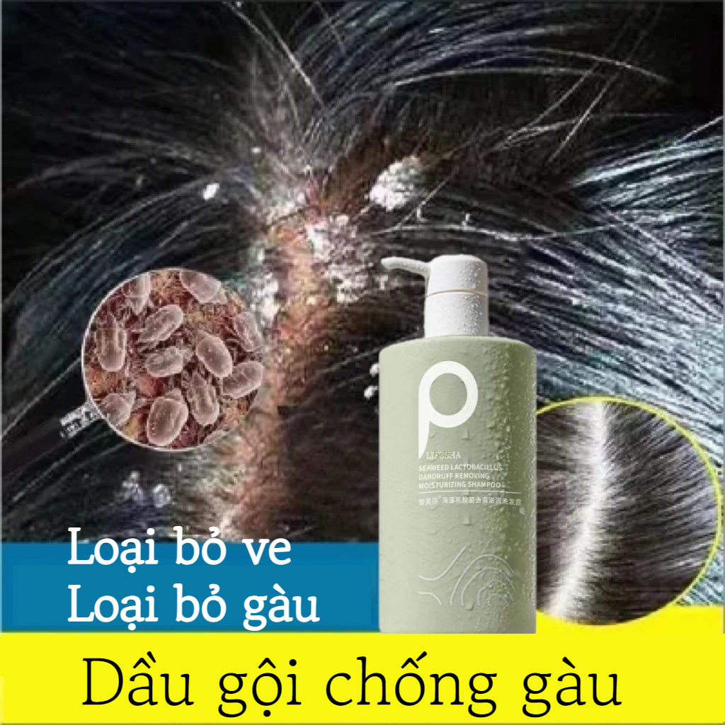 Dầu gội trị gàu dưỡng tóc dầu gội trị nấm da đầu Loại bỏ gàu, loại bỏ ve và làm sạch da đầu Kiềm Dầu Giảm Bết Tóc Hiệu Quả