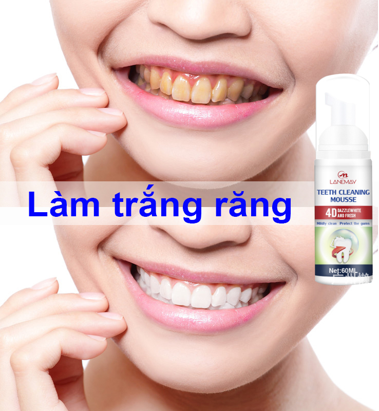 Kem đánh răng làm trắng răng,Kem đánh răng bọt,kem đánh răng mousse làm sạch răng,Làm sạch răng nhanh,Loại bỏ hơi thở hôi, loại bỏ mảng bám răng,làm trắng răng