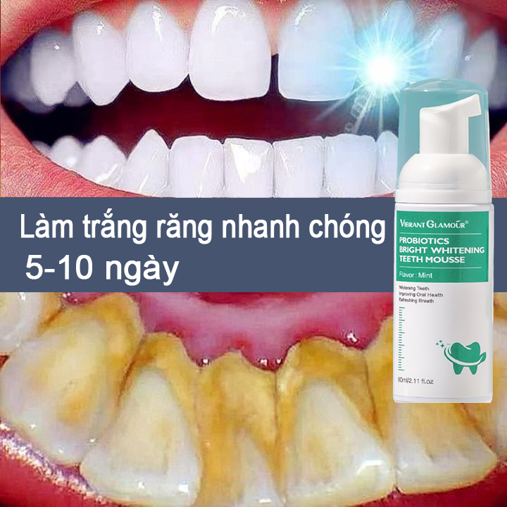 VIBRANT GLAMOR mousse làm trắng răng làm sạch răng mousse loại bỏ vết ố vàng răng làm trắng răng loại bỏ hôi miệng hơi thở thơm mát