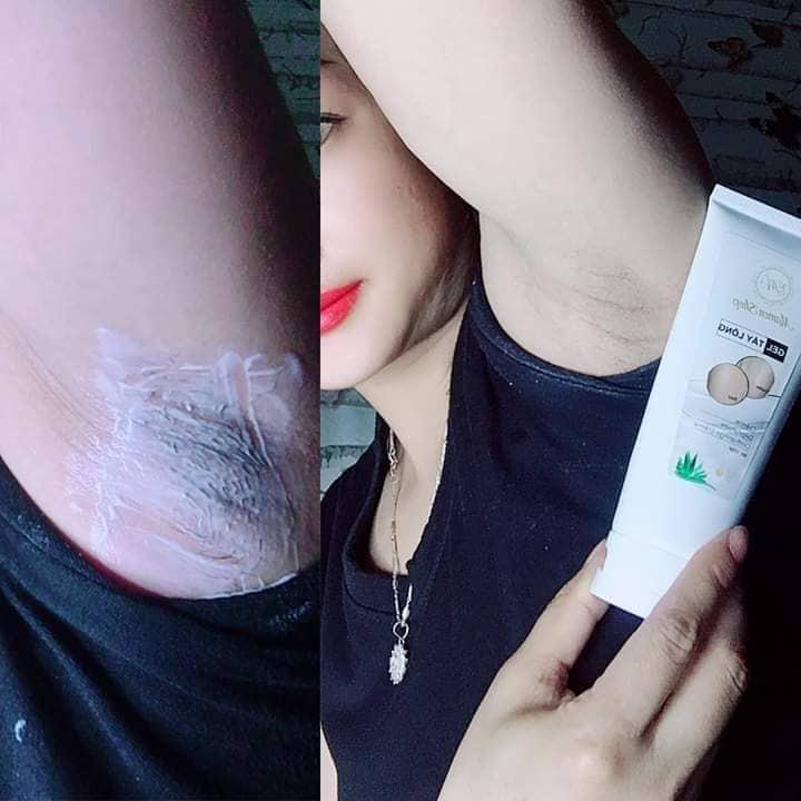 Kem tẩy lông râu vĩnh viễn mamen shop 120ml - triệt lông vĩnh viễn toàn cơ thể