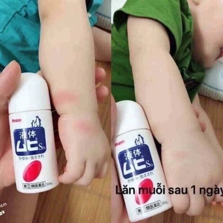 COMBO 2 Lăn muỗi đốt Muhi Nhật Bản chính hãng 50g, lăn bôi giảm ngứa muỗi và côn trùng đốt cho bé từ 6 tháng tuổi