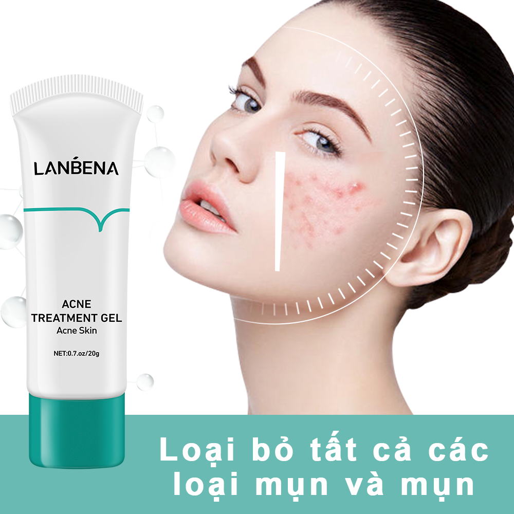 LANBENA Gel điều mụn giúp giảm mụn trứng cá và mụn nhọt làm mờ các vết mụn dưỡng ẩm và phục hồi da 20g - intl