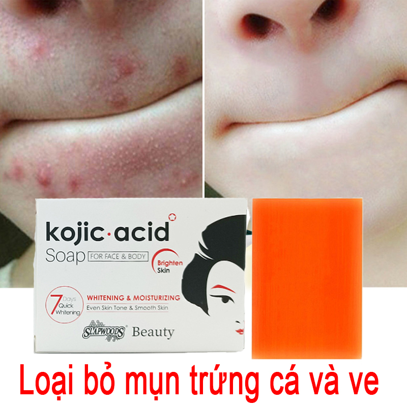 Whitening soap, kojic acid soap, papaya soap, kojie San/kojiesan/kojisan/kojic acid soap 100g remove pimples and eliminate hair follicles