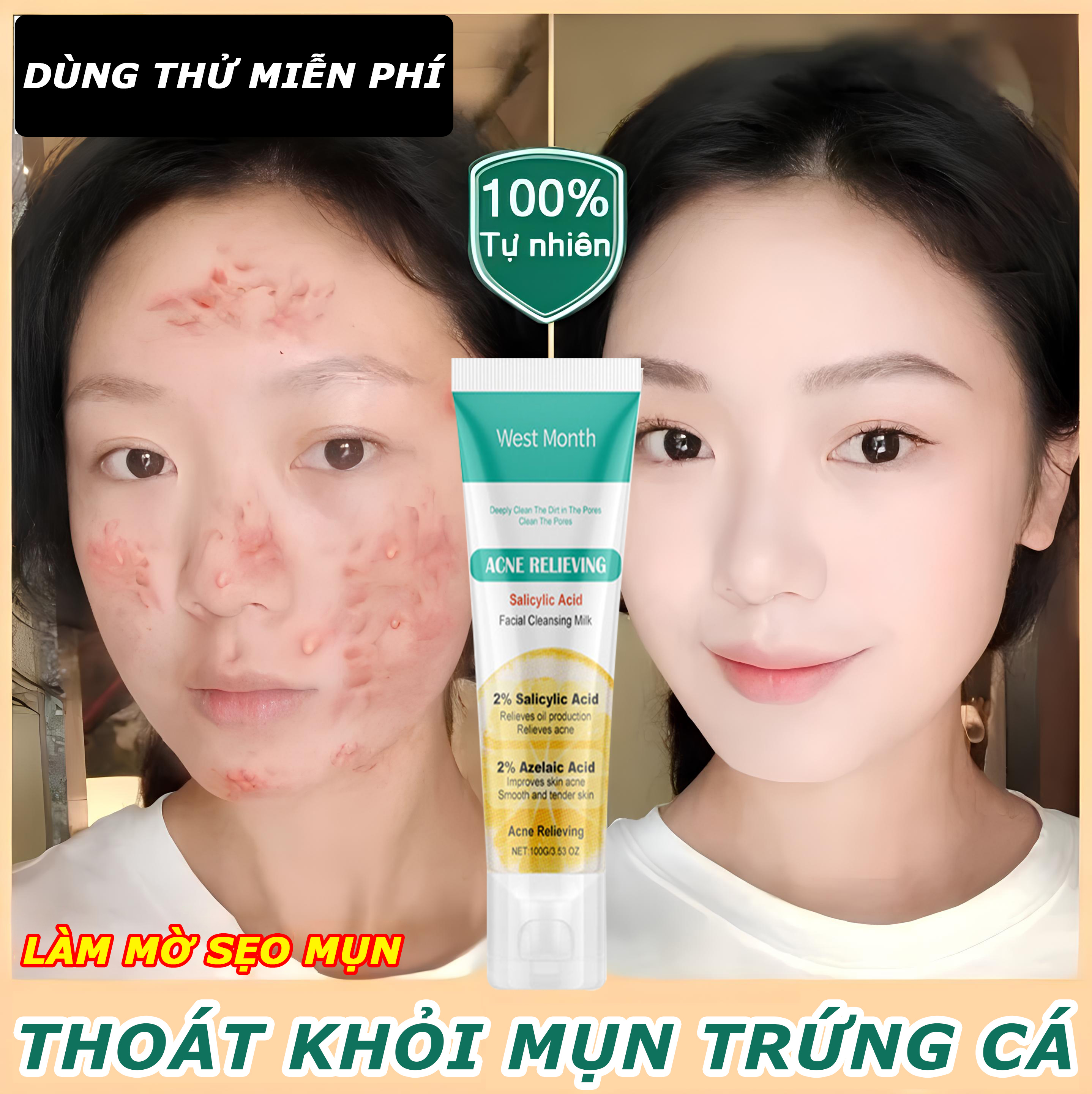 Kem loại bỏ mụn nhanh chóng loại bỏ mụn bọc, phục hồi vết tích mụn và chống viêm mụn, làm mờ thâm mụn,Kem Giảm Mụn Kem dưỡng giảm mụn mặt nạ giảm mụn tàn nhang làm trắng dưỡng ẩm 30g