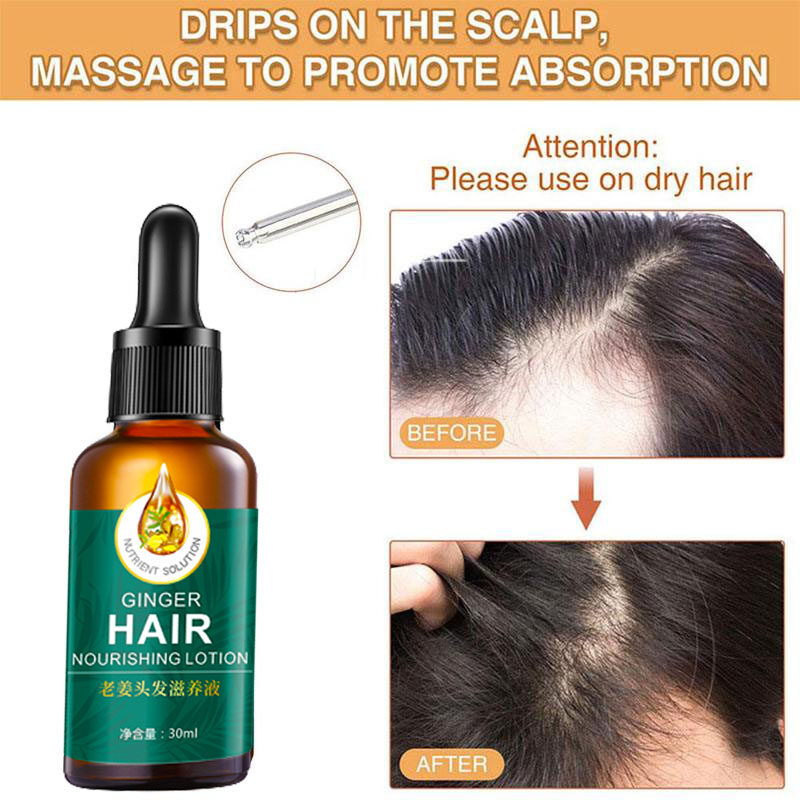 30ml】Ginger hair growth oil hair growth beard growth serum Hair growth nutrient solution hair loss repair hair follicle promote hair growth balance oil improve frizz hair smooth protection liquid 30ml】Ginger hair growth oil hair growth beard growth serum Hair growth nutrient solution hair loss repair hair follicle promote hair growth balance oil improve frizz hair smooth protection liquid