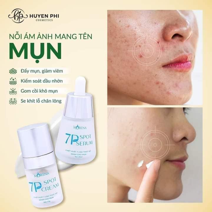 Combo serum mụn 7P và kem chấm mụn 7P Huyền Phi, sạch mụn mờ thâm, cấp ẩm cho da