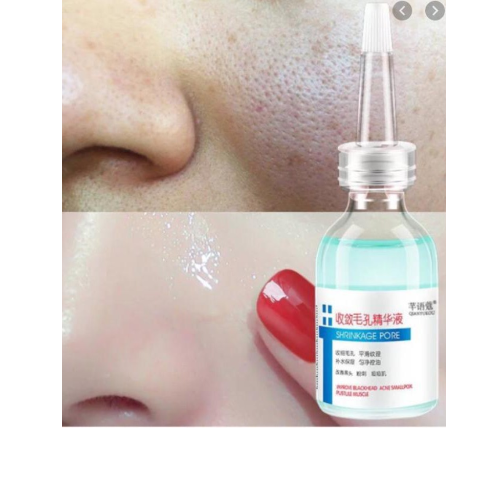 Tinh chất dưỡng ẩm se khít lỗ chân lông Shrinkge pore 30ml