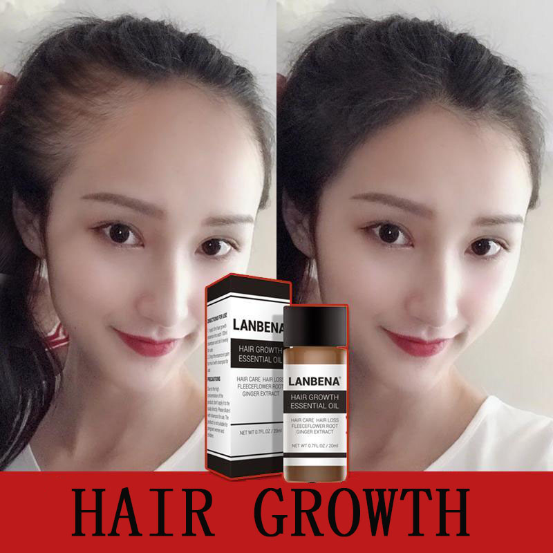 [HCM]Tinh chất ngăn ngừa rụng tóc kích mọc tóc nhanh chóng