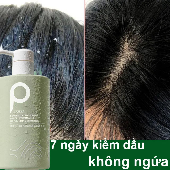  Dầu gội đầu muối biển dầu gội đầu loại bỏ gàu dầu gội loại bỏ tế bào chết dầu gội chống ngứa 500ml loại bỏ ngứa ngáy vảy nến hiệu quả làm sạch da đầu mạnh mẽ Sea salt shampoo 