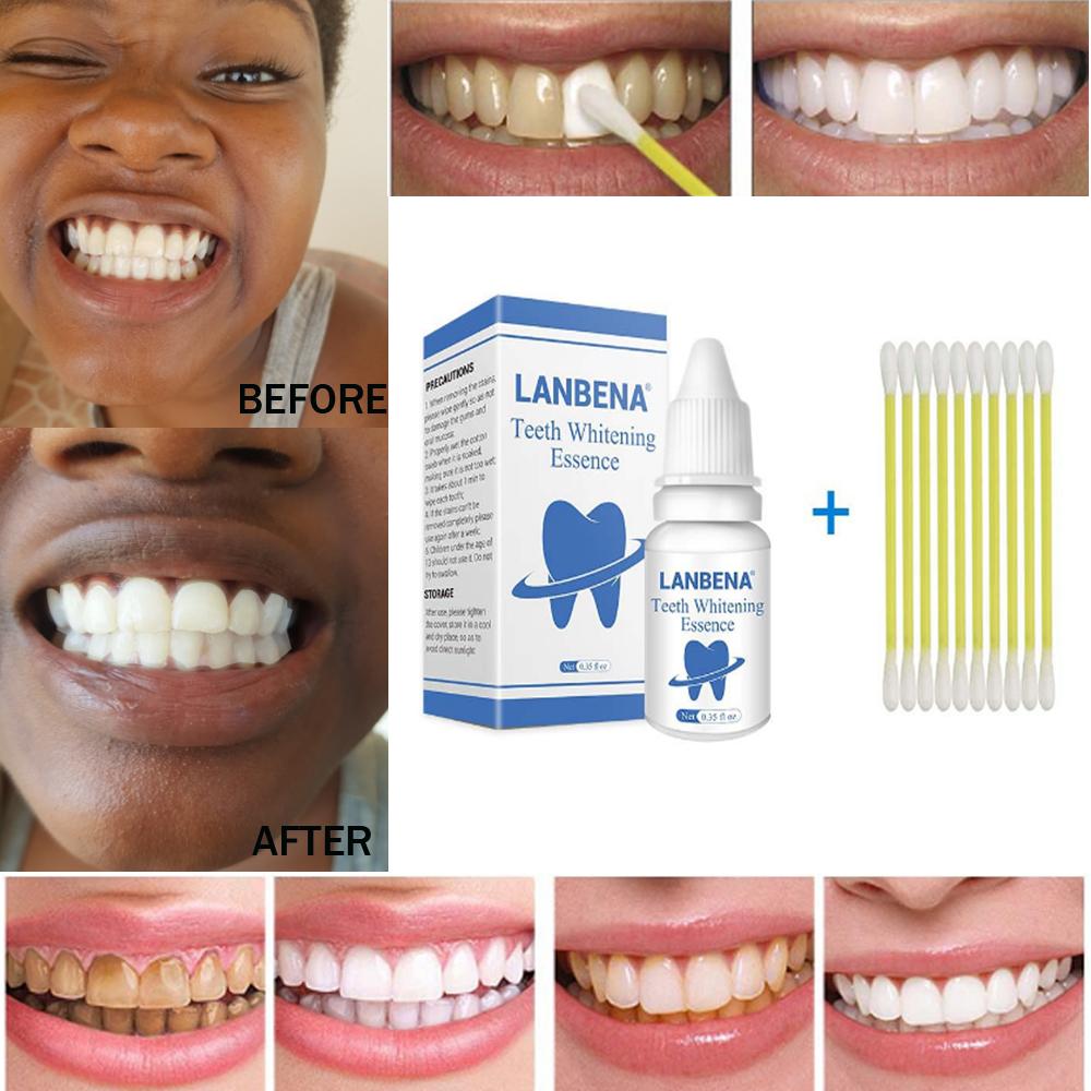 [HCM]TRẮNG RĂNG Teeth clean spot cleaning LÀM SẠCH RĂNG teeth whitening TRẮNG RĂNG teeth White Intensive Whitening Treatment