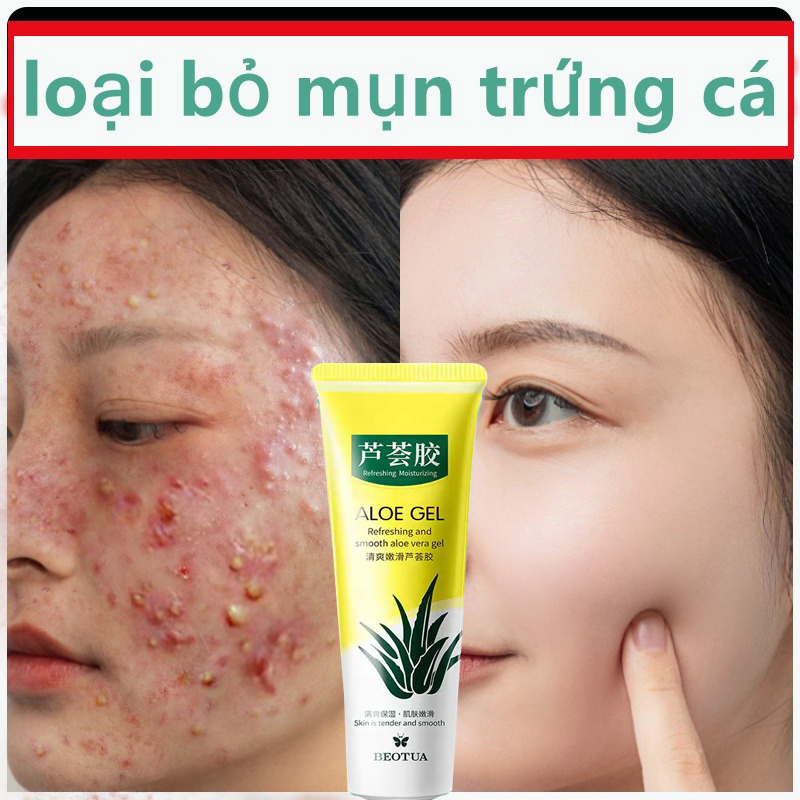  Gel nha đam 40g Dưỡng ẩm Chống lão hoá Trị mụn trứng cá Mờ sẹo Gel chống nắng Dịu nhẹ không kích ứng 