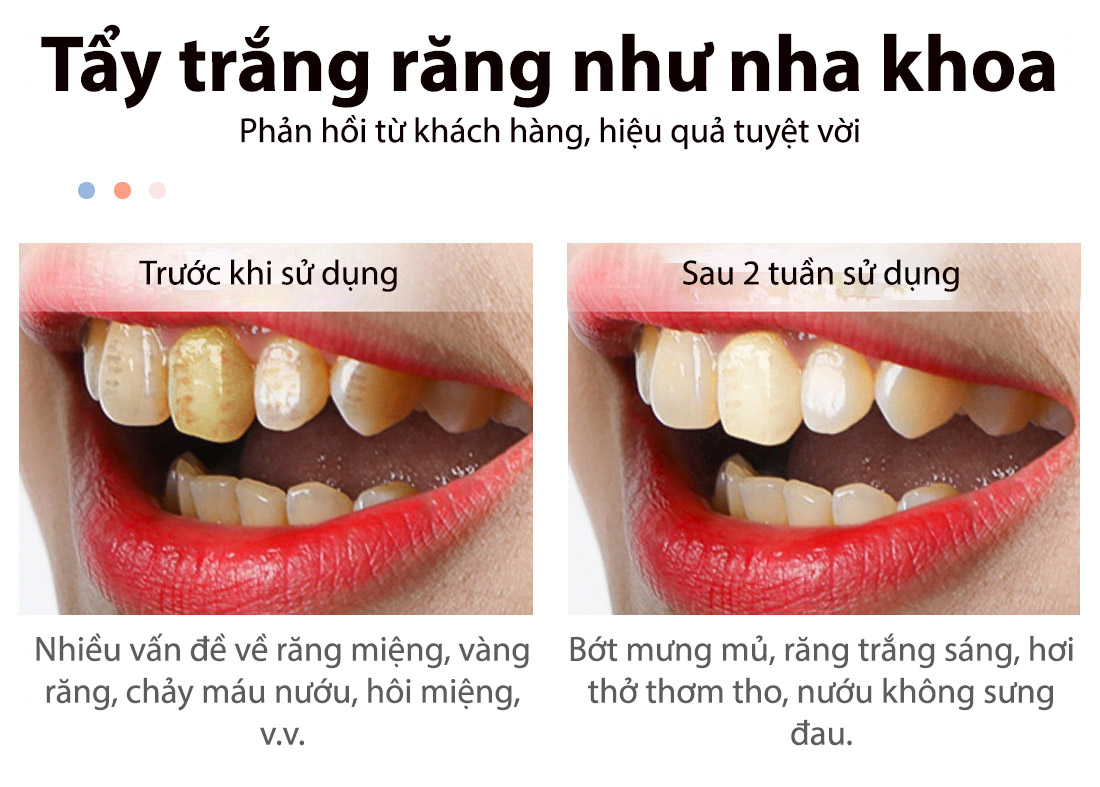 [hcm]rtopr bọt tẩy trắng răng làm sạch răng khử mùi hôi miệng mousse teeth whitening clean teeth 60ml 3