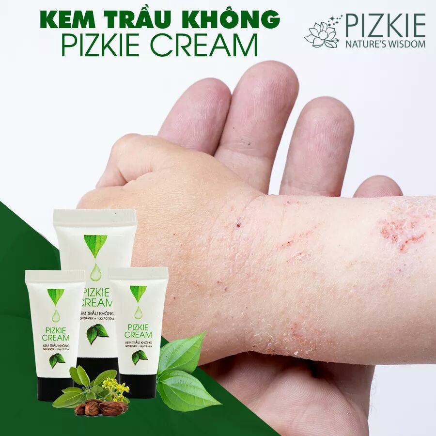 Kem trầu không tác dụng giảm ngứa 30gr