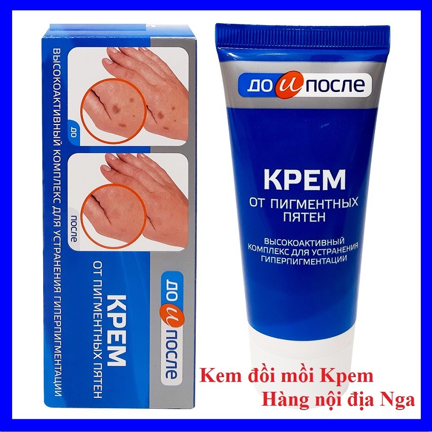 Kem đồi mồi Kpem 50ml Nga, dưỡng da, hết đồi mồi, mờ thâm, giảm nếp nhăn