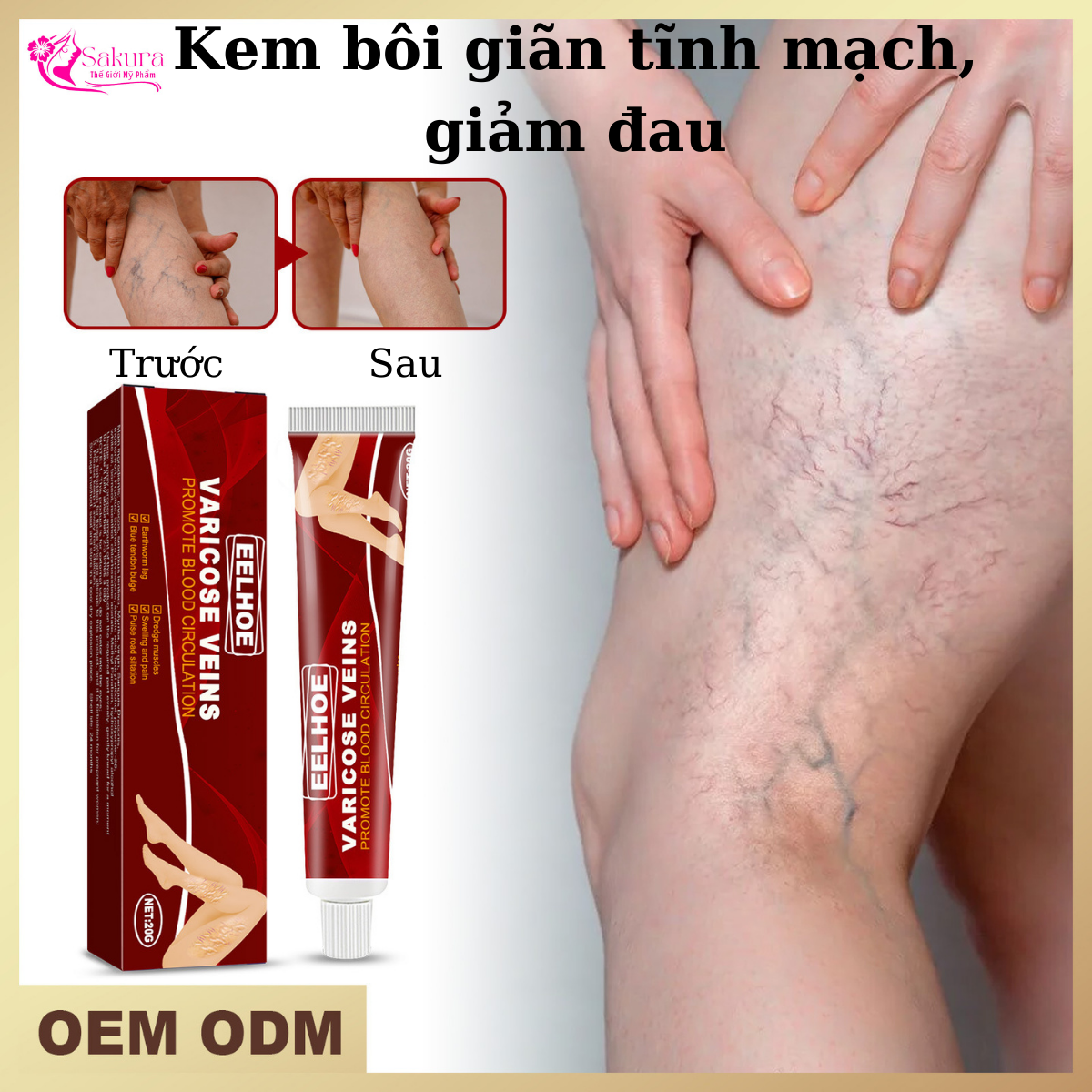 Kem bôi suy giãn tĩnh mạch giúp giảm đau vùng chân cải thiện tuần hoàn máu làm dịu đau chân loại bỏ sưng mạch máu chân phồng gân xanh