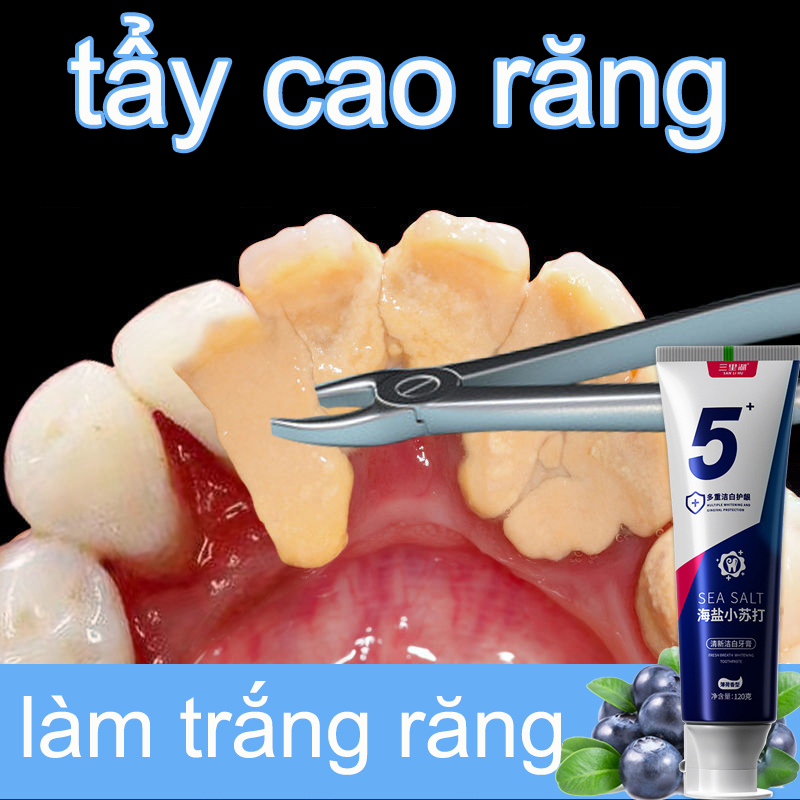 Kem đánh răng làm trắng răng Kem đánh răng 100g nhanh chóng loại bỏ mảng bám trên răng và khử mùi hôi miệng
