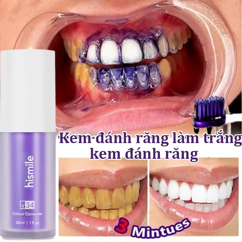 Serum làm trắng răng hismile v34 kem đánh răng tẩy trắng răng tại nhà