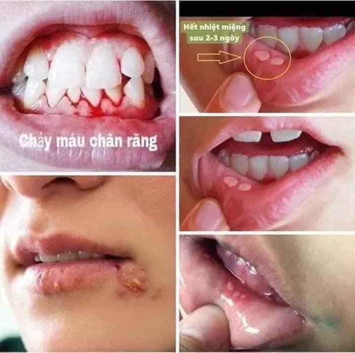 Tinh dầu dạ thảo liên