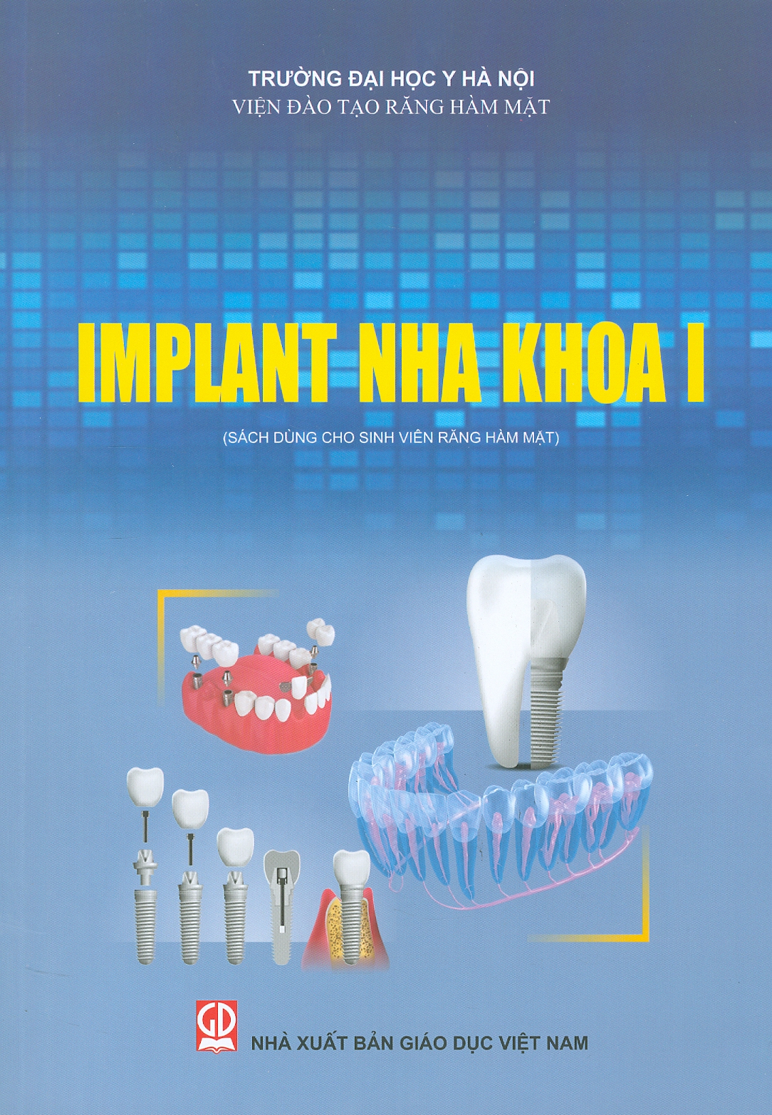 Implant Nha Khoa I