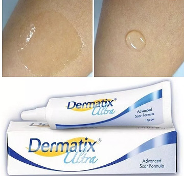 Kem Dermatix Ultra hỗ trợ làm phẳng mềm và mờ sẹo lồi sẹo thâm sẹo phì đại
