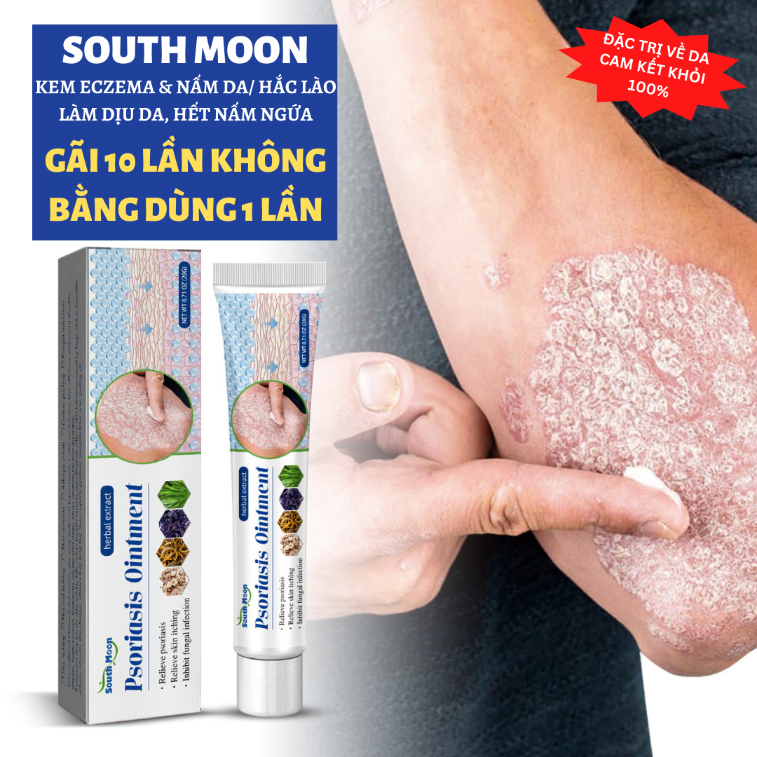 Kem bôi ngoài da hắc lào lang ben nấm da mề đay viêm da cơ địa á sừng vảy nến tổ đỉa viêm da dị ứng viêm da dầu viêm da dị ứng ngứa nứt nẻ nước ăn chân tay...