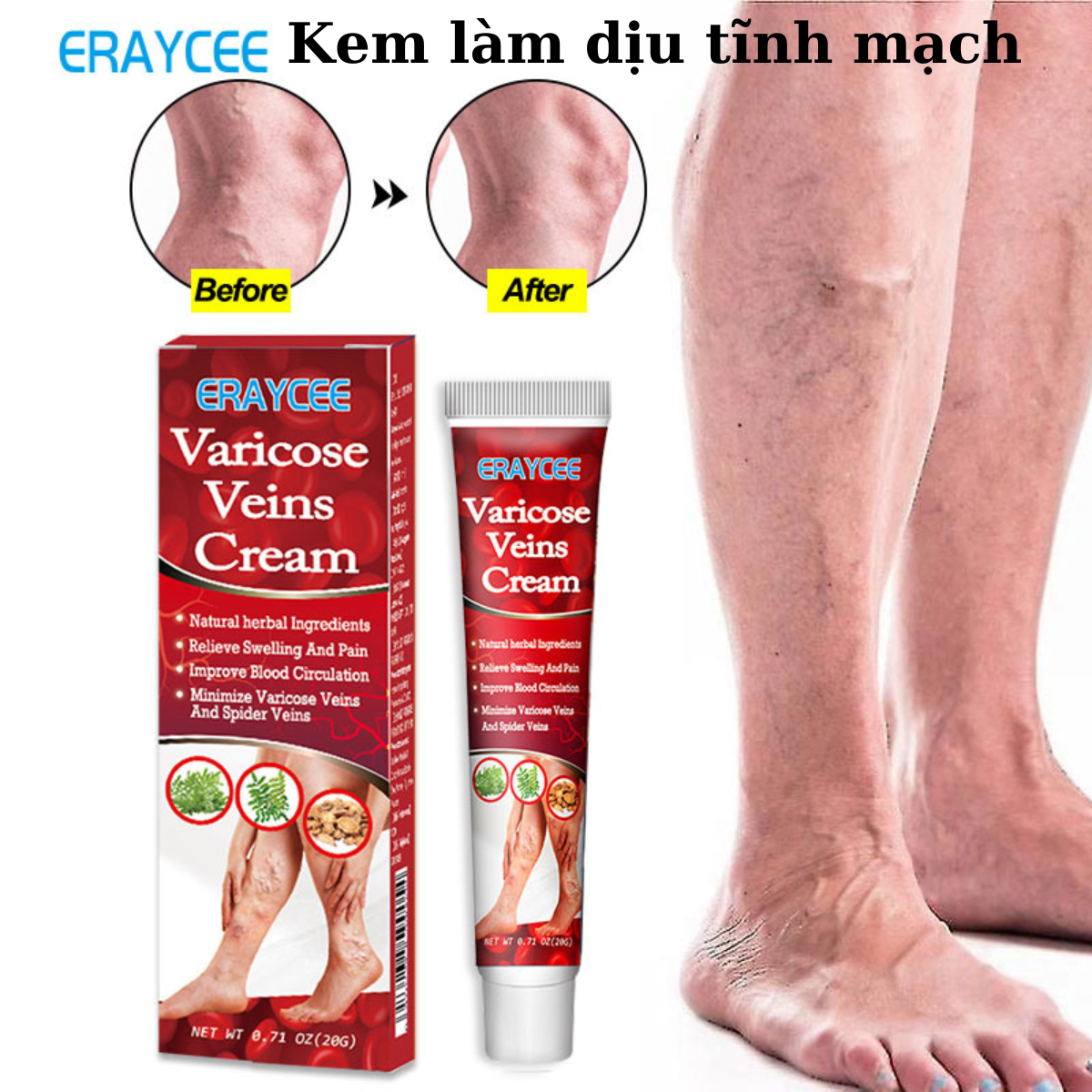 Kem Bôi Tĩnh Mạch Giảm Sưng Tấy Đau Nhức Do Giãn Tĩnh Mạch chăm sóc vùng chân cải thiện tuần hoàn máu, Kem bôi ngoài da