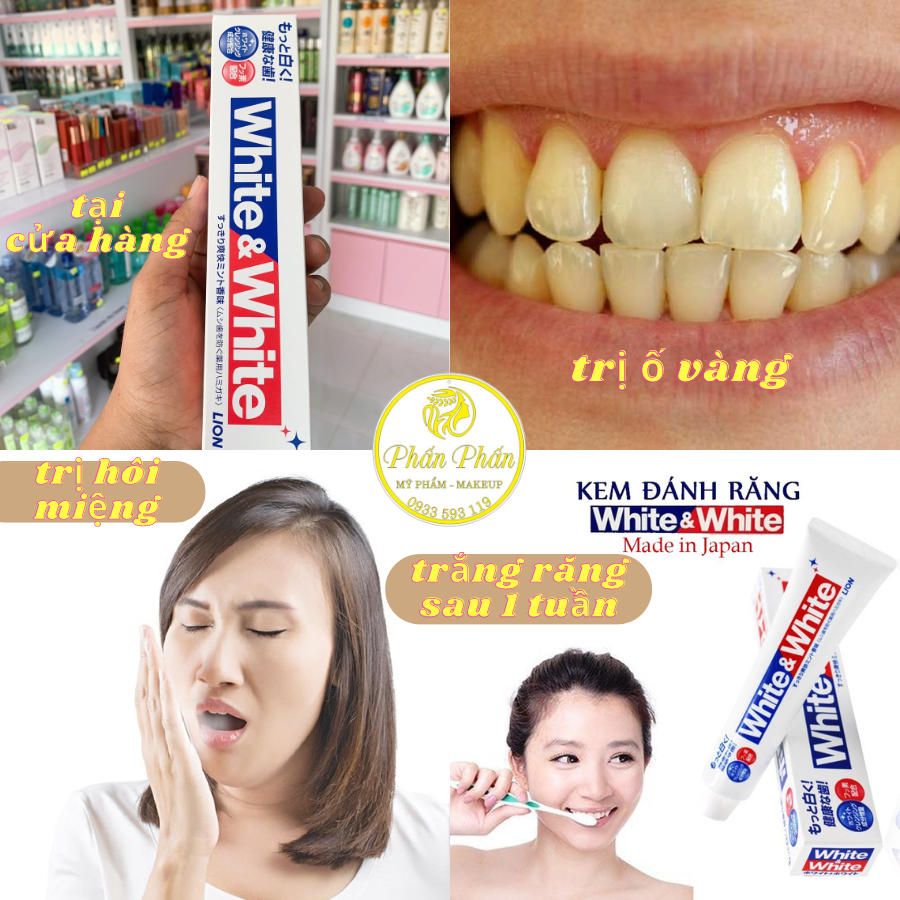 Kem đánh răng white & white 150g - hàng nhật nội địa