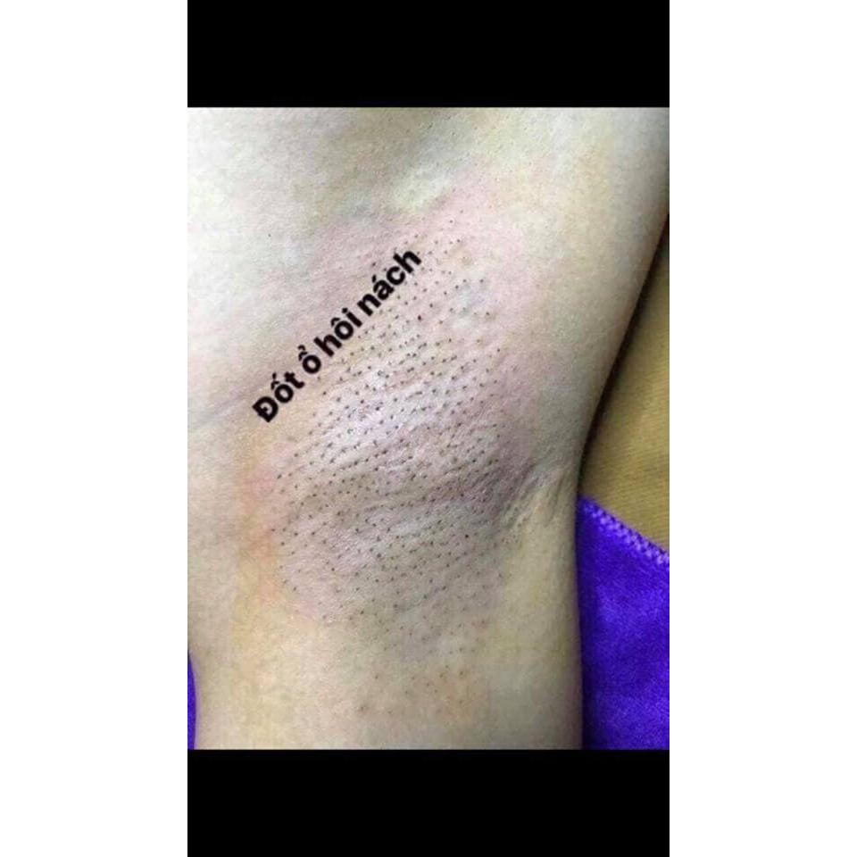 Bột Bôi Ổ Hôi Nách Sau Đốt