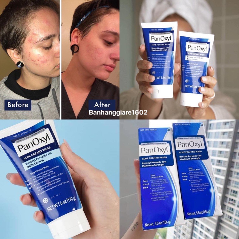 Sửa rửa mặt PanOxyl Acne Foaming Wash 10 Benzoyl Peroxide 162ml SẴN BILL MỸ