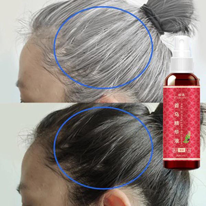 Thuốc xịt tóc đen, làm đen tóc vĩnh viễn, ngăn ngừa tóc bạc, chiết xuất thảo dược Polygonum multiflorum, nhẹ nhàng và không gây kích ứng 100ml,hiết xuất thảo mộc đen tóc tự nhiên dịu nhẹ không kích ứng không cần nhuộm tóc