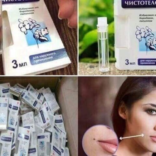 Gel tẩy mụn thịt, mụn cóc, nốt ruồi nga cynep