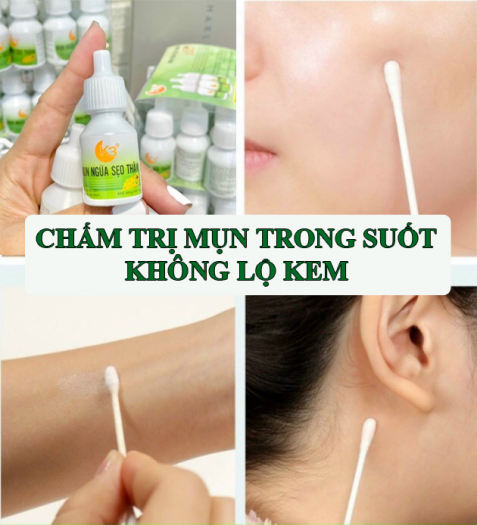 Kem chấm mụn siêu tốc mụn đầu đen, trứng cá, mụn bọc mờ thâm liền sẹo K3 - SPA88