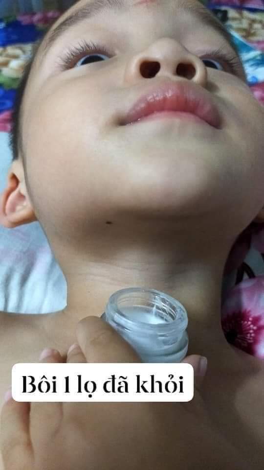 THẢO MỘC BÔI DA Trần Kim Huyền viêm da cơ địa