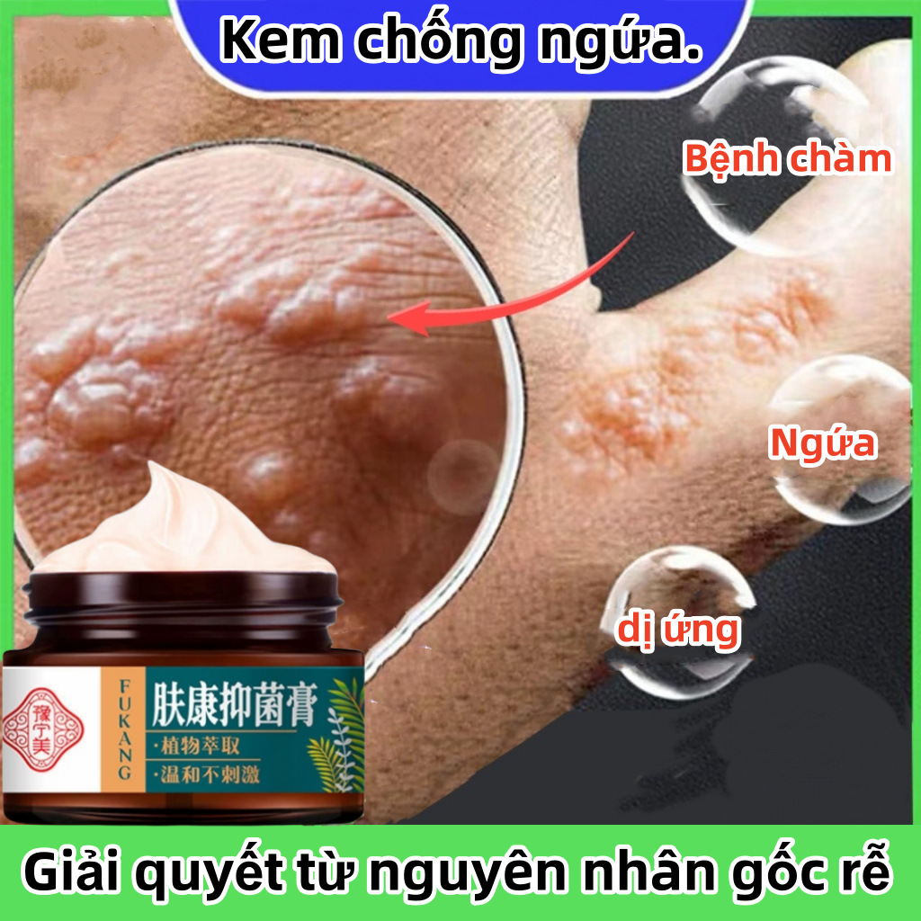  kem bôi nấm ngứa thuốc bôi nấm ngứa thuốc trị lang ben viêm da cơ địa thuốc nấm kutieskin trị nấm candida thuốc dị ứng 